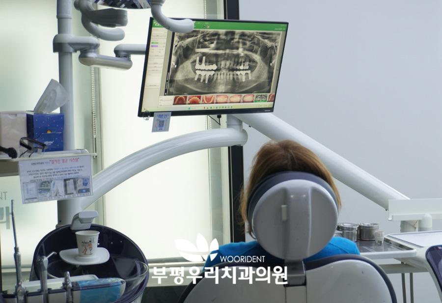 임플란트 시술 후 관리