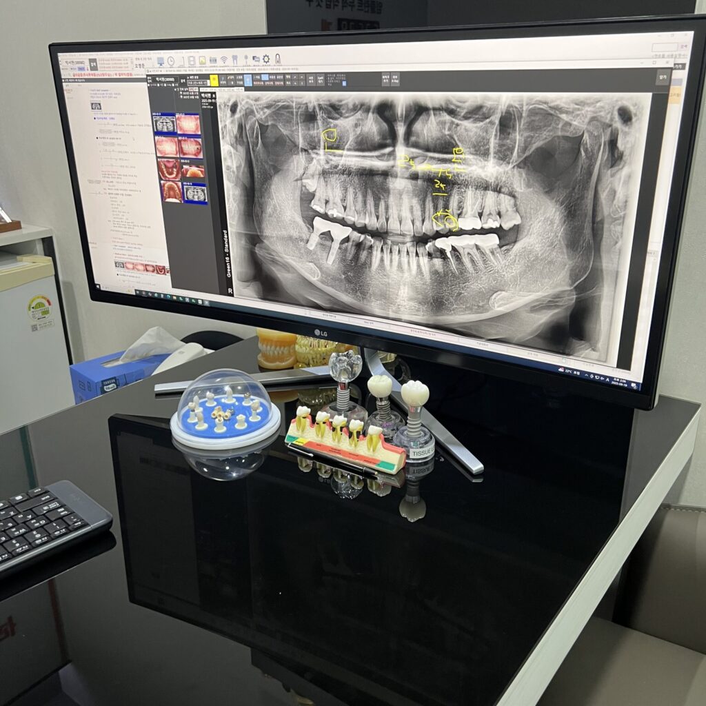부평동 뼈이식 임플란트 너무 걱정만 하실 필요는 없습니다