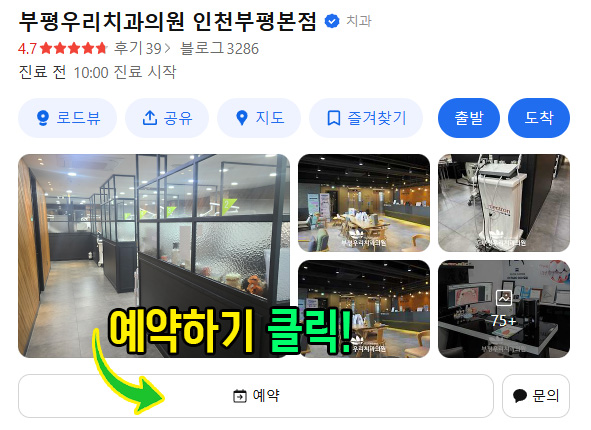 충치치료잘하는곳
