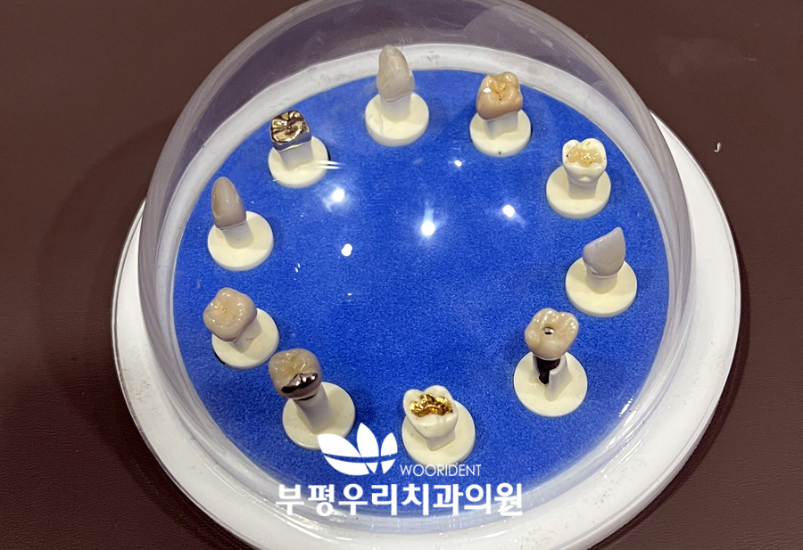 크라운이란 무엇인가?